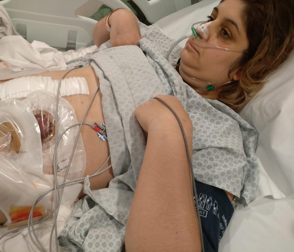 Amigos abrem vaquinha para dieta e higiene de jovem que teve de refazer colostomia