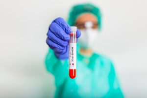 monkeypox x varíola dos macacos
