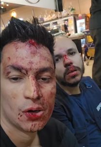 Caíque Marcatt e Valdir Pimenta, após serem agredidos, perto da padaria São Bento
