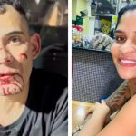 douglas alves da silva atropela e arrasta ex