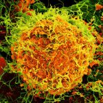 Micrografia eletrônica do vírus Ebola