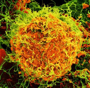 Micrografia eletrônica do vírus Ebola
